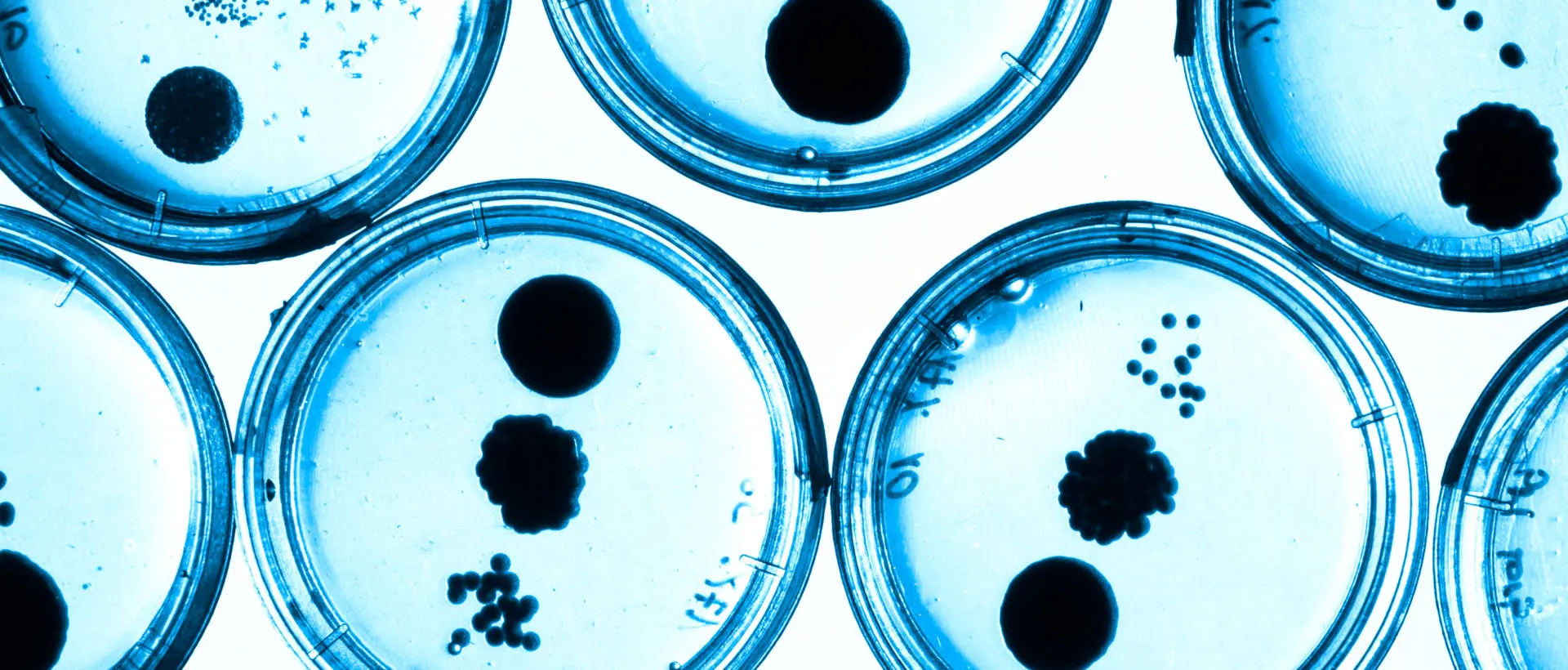 Growing Bacteria in Petri Dishes.